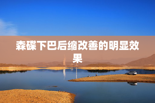 森碟下巴后缩改善的明显效果