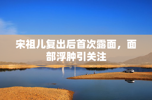 宋祖儿复出后首次露面，面部浮肿引关注